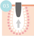 タンパク質が凝固