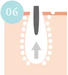 タンパク質凝固